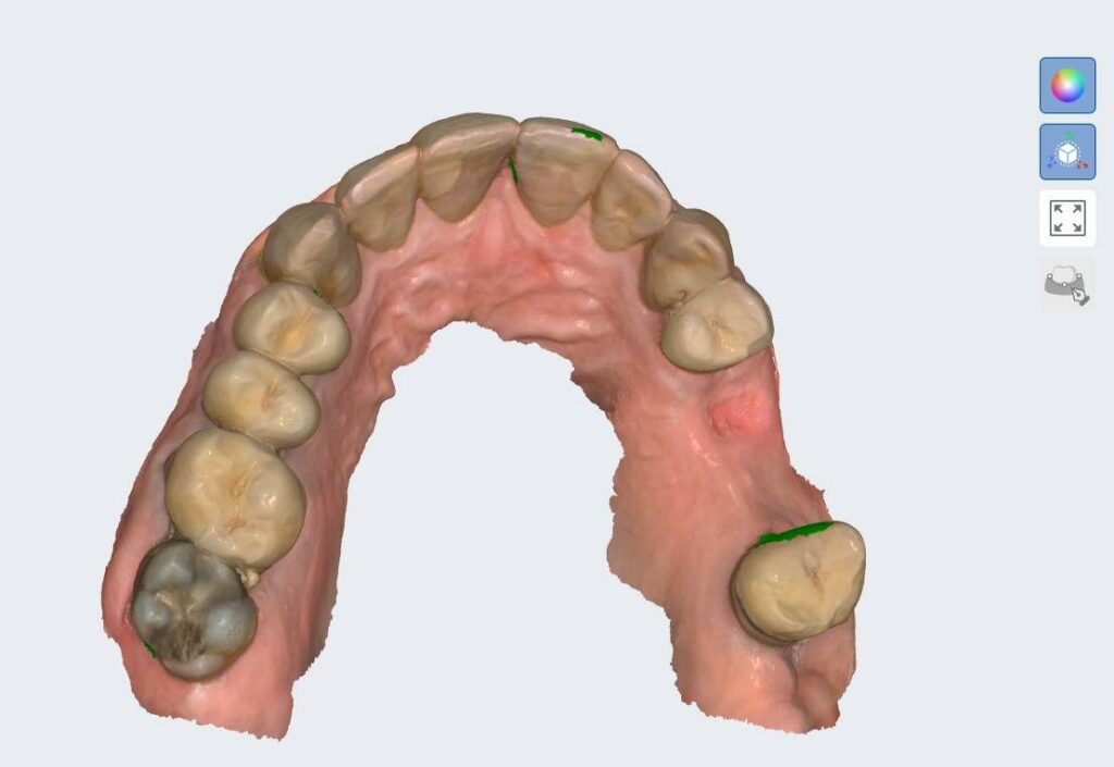 AI assisted dental reconstruction